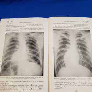 tm8-275-military-x-ray-manual-1942-medical-wwii-medicine-